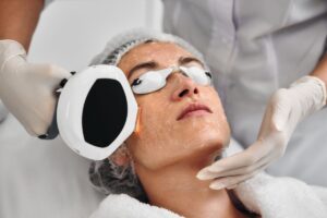 Lee más sobre el artículo Fotorejuvenecimiento IPL en Santander: mejora manchas, tono y luminosidad de la piel
