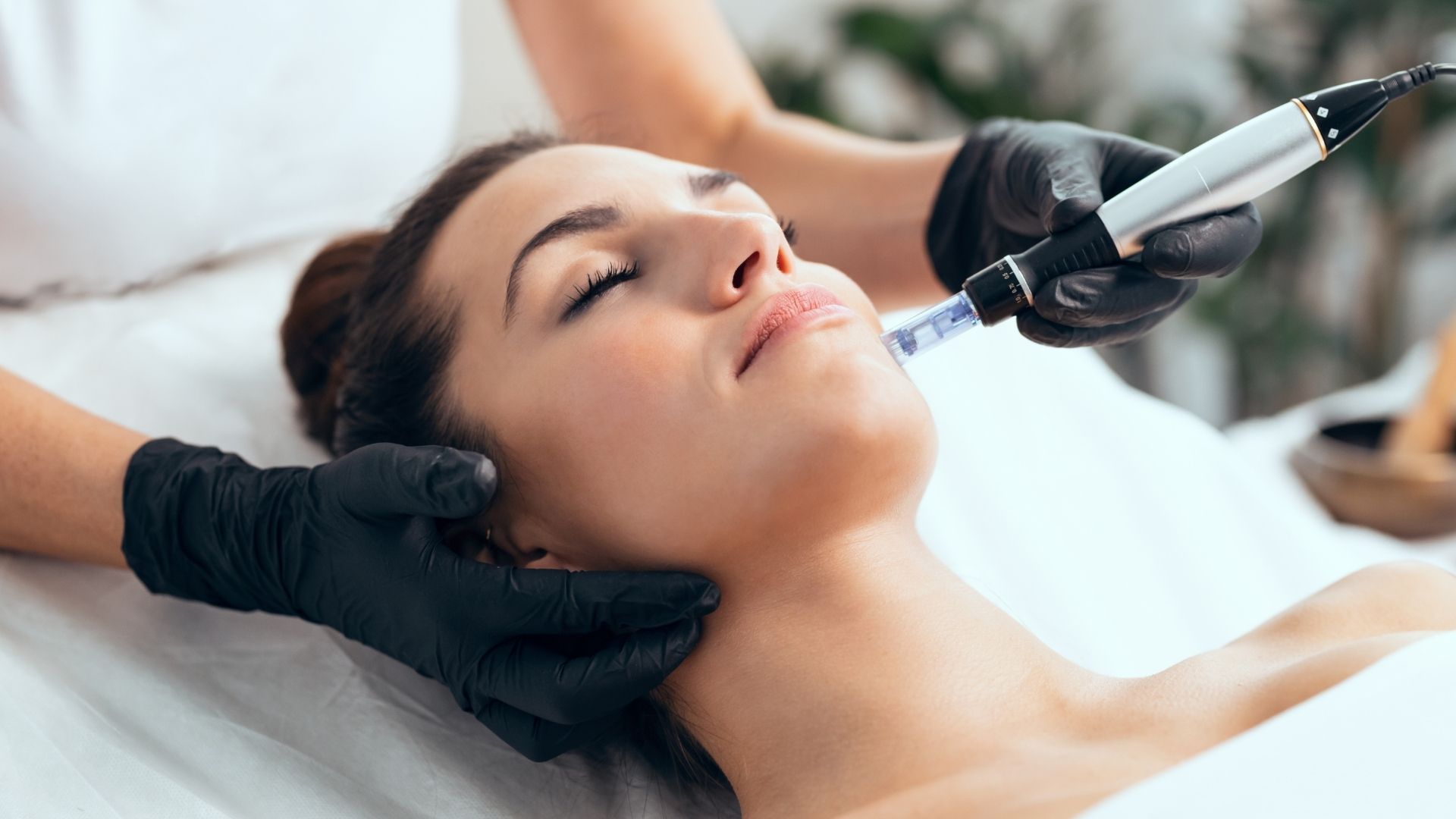 Lee más sobre el artículo Mesoterapia en Santander